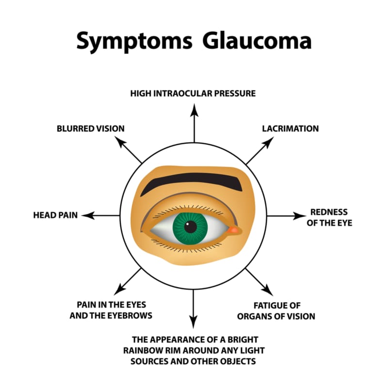 Glaucoma 1